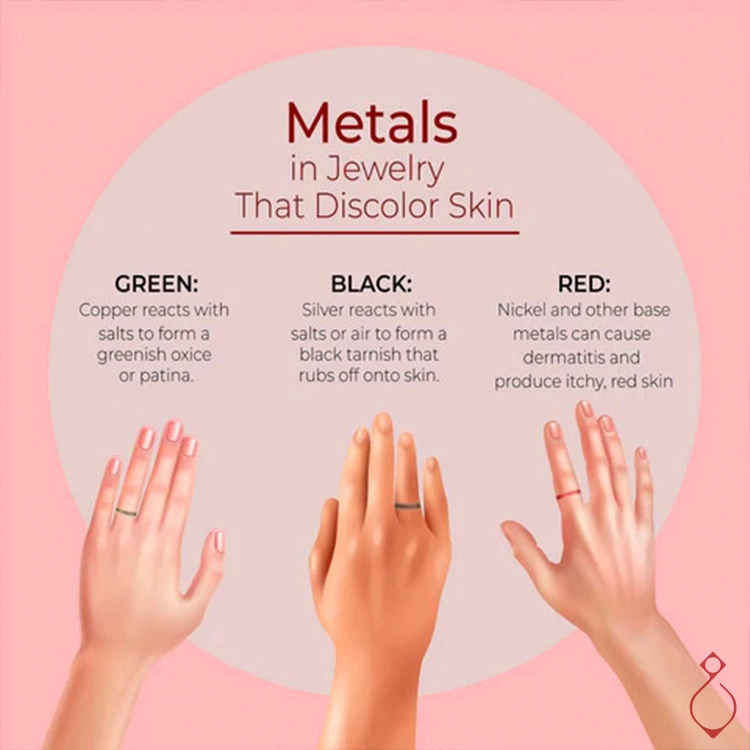 چرا طلا پوست را سیاه و سبز می کند؟